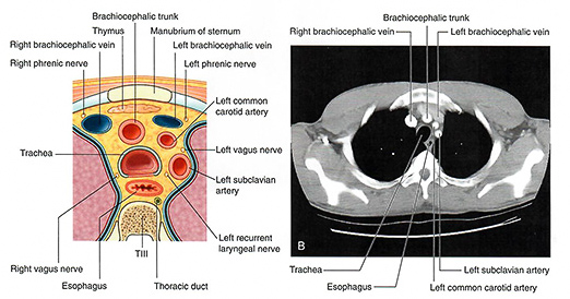 Axial major vessels