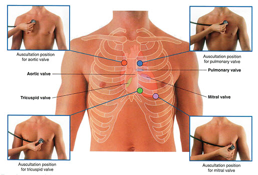Auscultation