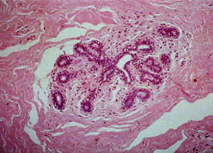 Normal Breast