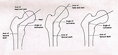 hipangle