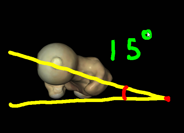 torsionangle